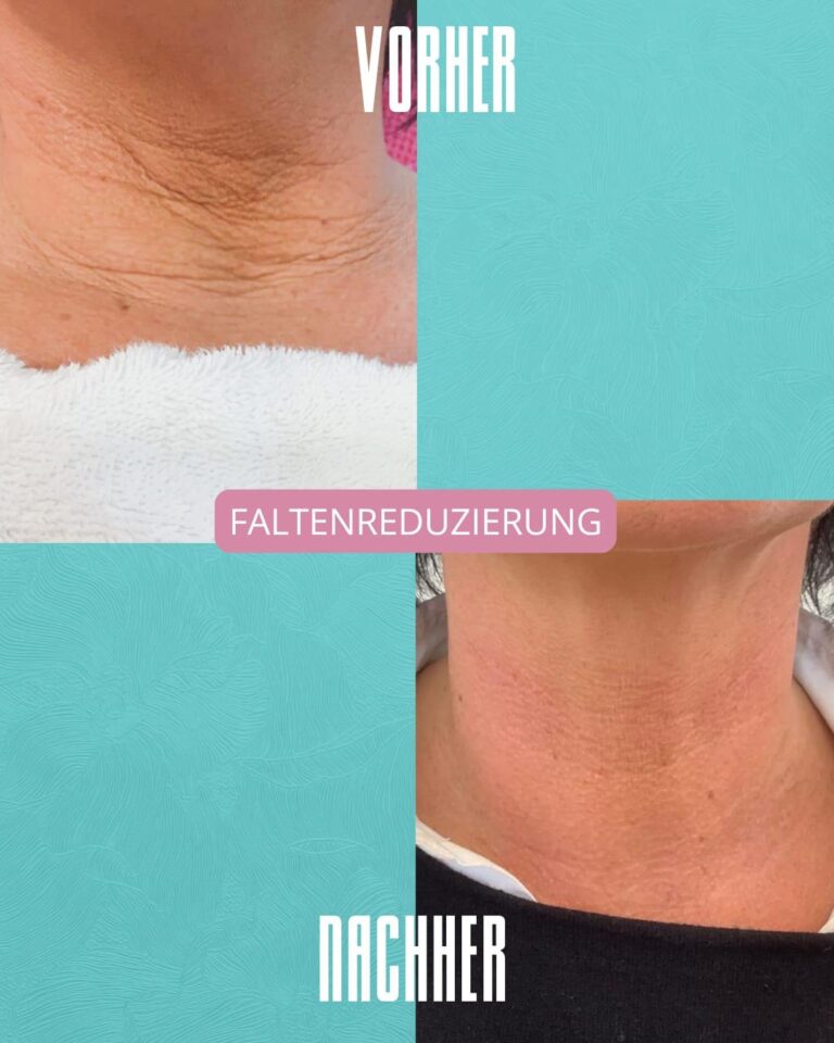 Vorher_Nachher3