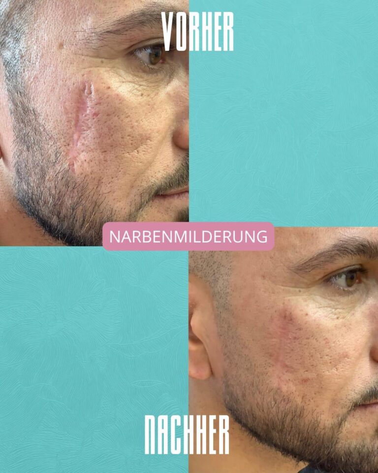 Vorher_Nachher4